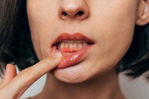 Lady has inflamed gums