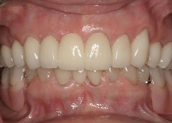 Closeup of healthy bright smile