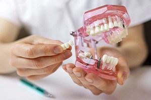 Dentist holding sample implant bridge to model teeth with transparent pink base