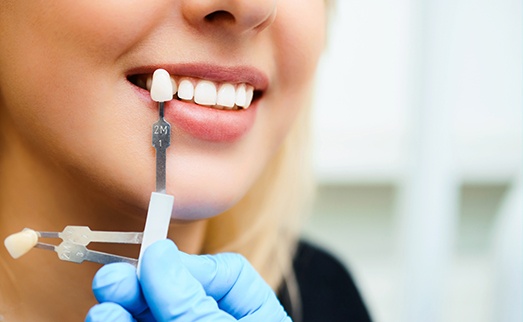 Woman's smile compared with tooth color short