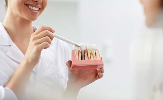 dentist showing a dental implant model to a patient