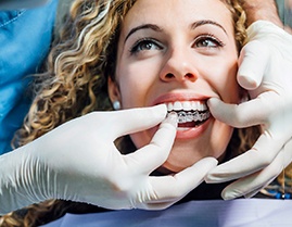 A dentist inserting Invisalign trays in Carlisle