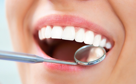 Closeup of smile during dental exam