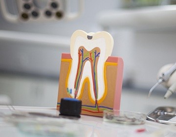 Model of the inside of the tooth