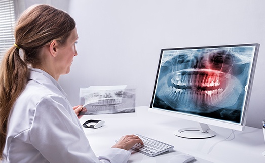 Digital dental x-rays