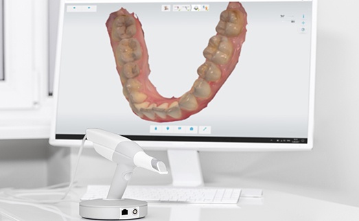 Digital impression system